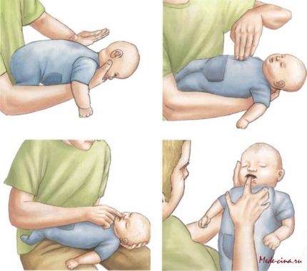 Как вытащить пуговицу из детского уха - советы кременчугских медиков