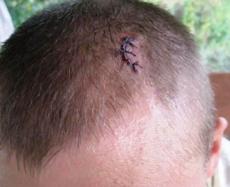 В Кременчуге пассажир маршрутки рассёк голову о кусок металлического профиля, торчащего из полки