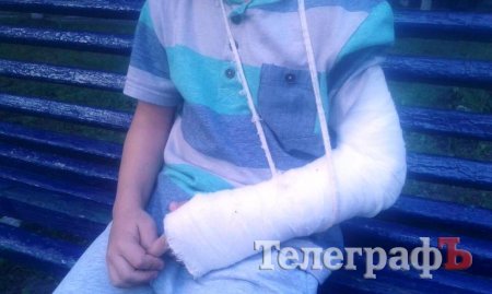 В Кременчуге 6-летний мальчик сломал руку, упав с детской горки в развлекательном центре