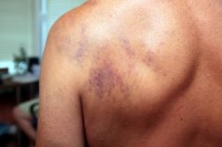 Во время урагана едва не утонул кременчужанин — спасатели его не нашли