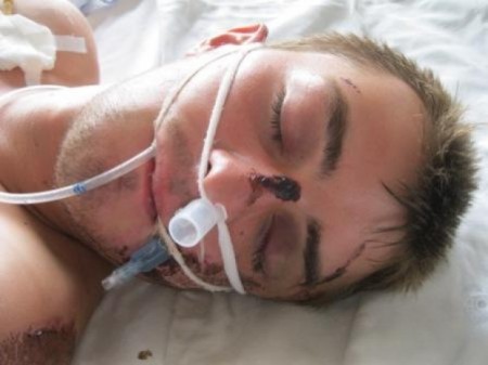 Кременчужан просят опознать упавшего на дорогу скутериста (ФОТО)