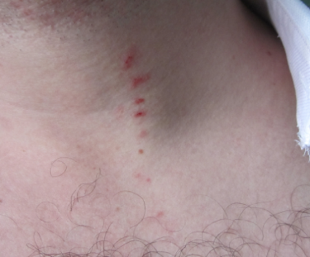 Депутат полтавского горсовета заявил, что его поцарапал мэр Мамай