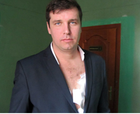 Депутат полтавского горсовета заявил, что его поцарапал мэр Мамай