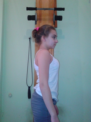 Лечение сколиоза у детей по программе «Осанка»