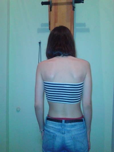 Новый метод лечения заболеваний позвоночника