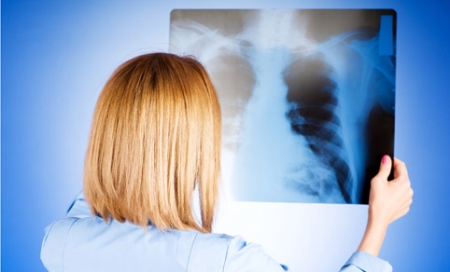 Пятеро кременчужан с пневмонией находятся в реанимации