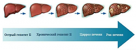 Коли манікюр може дорого коштувати…