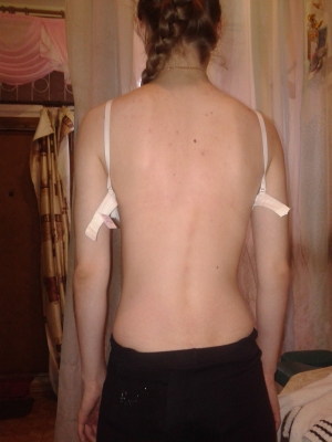 Как навсегда победить боль в спине