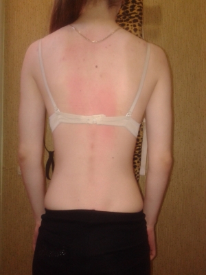 Как навсегда победить боль в спине