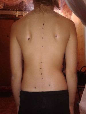 Как навсегда победить боль в спине