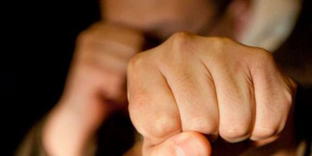 Поздно вечером в центре города подстрелили и избили кременчужанина