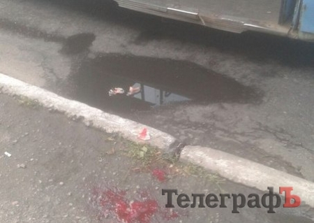 Кременчужанка разрезала ногу при выходе из троллейбуса