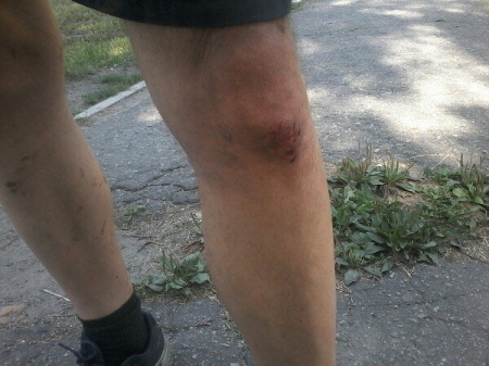 Конфликт между перевозчиком и бывшим водителем: маршрутчик в больнице