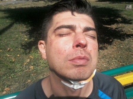 Конфликт между перевозчиком и бывшим водителем: маршрутчик в больнице