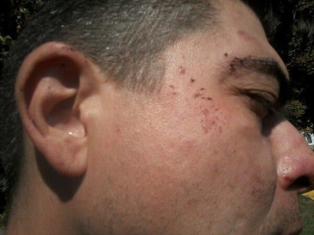 Конфликт между перевозчиком и бывшим водителем: маршрутчик в больнице