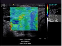 Немецкое качество расширяет диагностические возможности