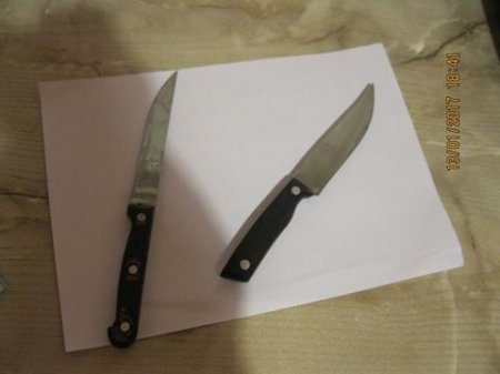 Из-за ссоры с коллегой кременчужанин лишился селезенки