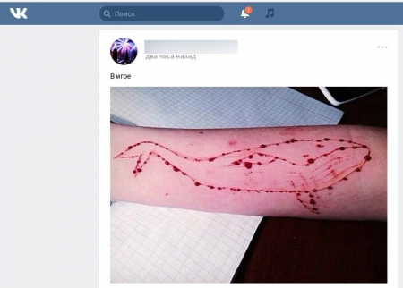 Заявка на самоубийство: психологи через соцсети доводят подростков до суицида