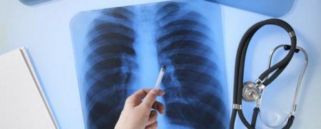 В одном из супермаркетов Кременчуга обнаружили кассира с туберкулезом