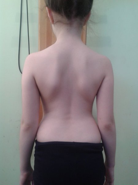 Внимание! Обратите внимание на осанку вашего ребенка.