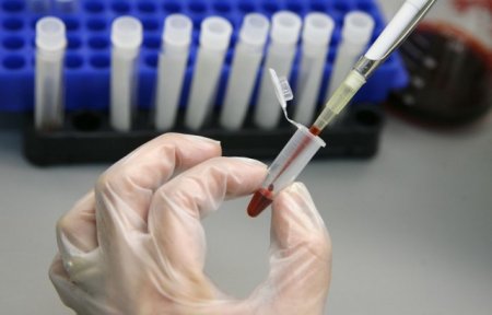 В Кременчуг попал «залетный» вирус гепатита А