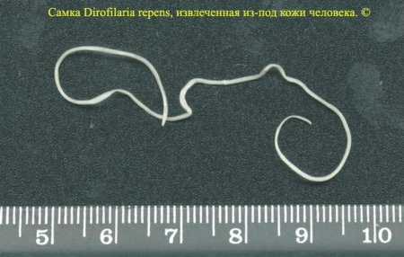 «Комарики-дзюбрики...»: Кременчужанка от укуса комара заразилась дирофиляриозом — подкожным червём