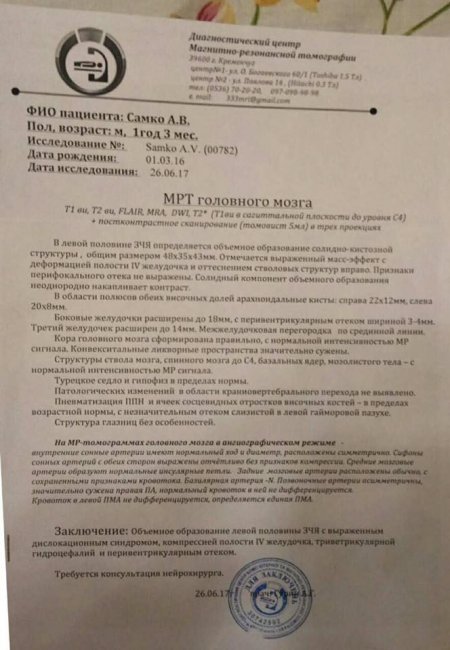 Маленький Артем Самко, у якого виявили пухлину мозку, терміново потребує допомоги