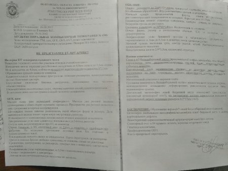 Якщо 14-річному Вадиму не замінити суглоб - ногу ампутують