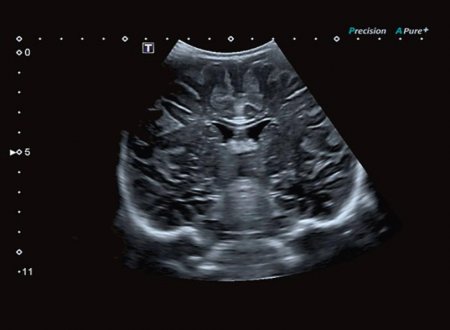 Медицинский центр семейного здоровья запустил в работу новейший ультразвуковой сканер экспертного класса Аплио