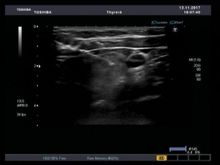 Медицинский центр семейного здоровья запустил в работу новейший ультразвуковой сканер экспертного класса Аплио
