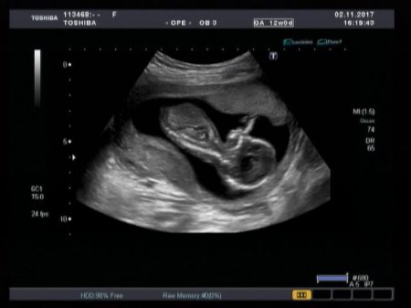 Медицинский центр семейного здоровья запустил в работу новейший ультразвуковой сканер экспертного класса Аплио