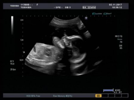 Медицинский центр семейного здоровья запустил в работу новейший ультразвуковой сканер экспертного класса Аплио