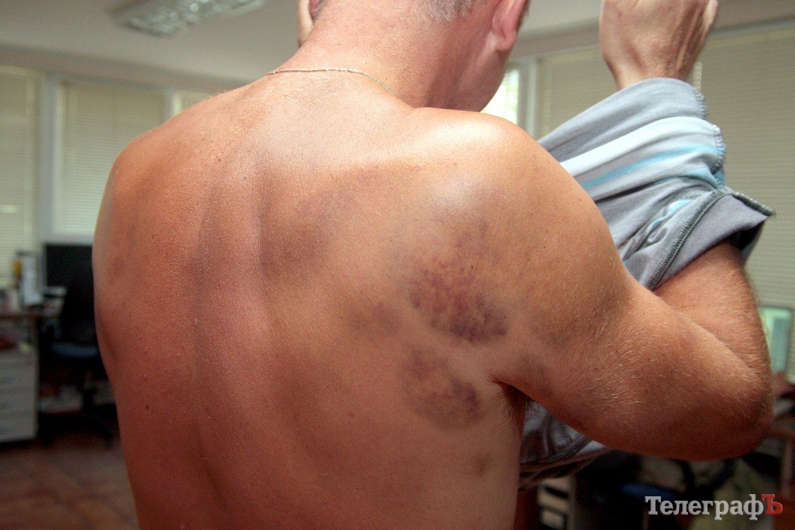 Во время урагана едва не утонул кременчужанин — спасатели его не нашли Во время урагана едва не утонул кременчужанин — спасатели его не нашли