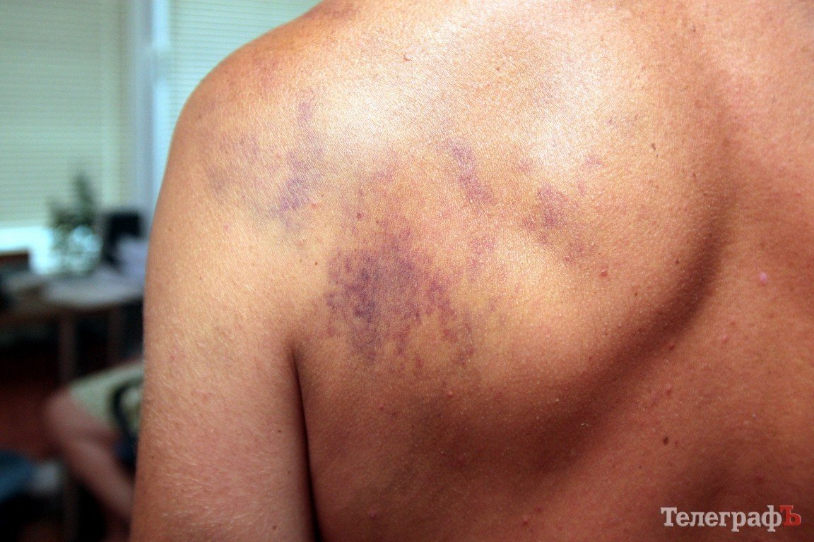 Во время урагана едва не утонул кременчужанин — спасатели его не нашли Во время урагана едва не утонул кременчужанин — спасатели его не нашли