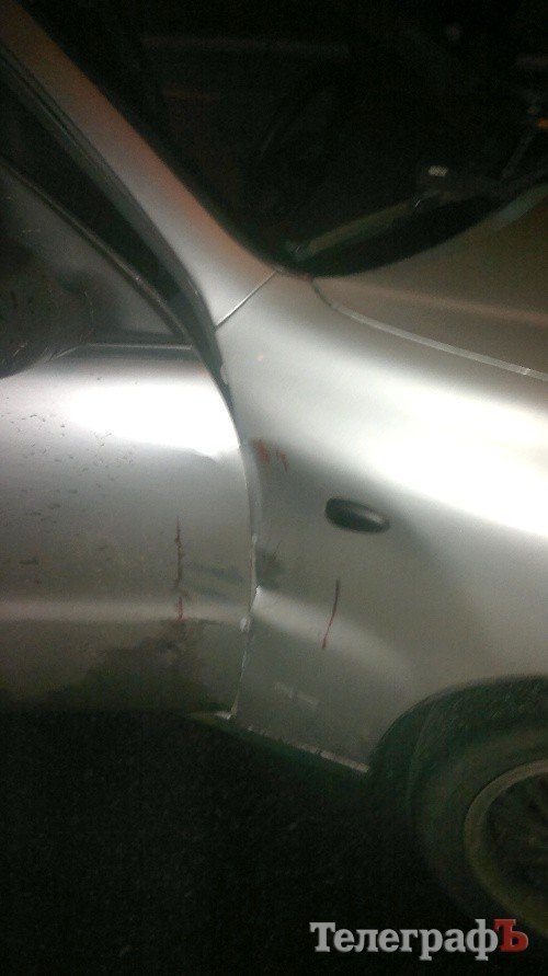 «Пока меня били, ППСники просто стояли рядом»: таксист «Пока меня били, ППСники просто стояли рядом»: таксист