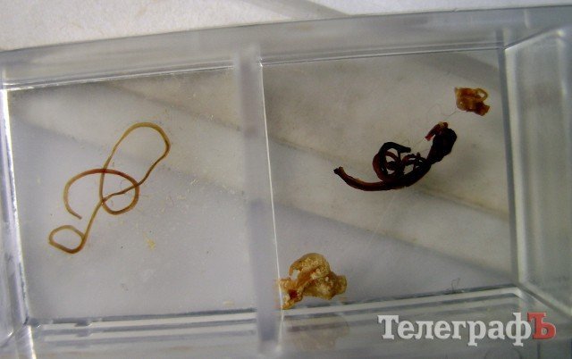 В кременчугской рыбе нашли новых паразитов, опасных для человека В кременчугской рыбе нашли новых паразитов, опасных для человека