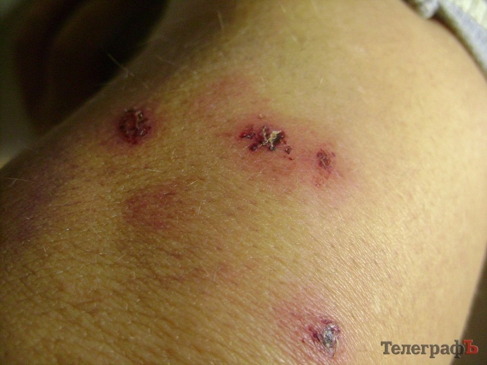 Кременчугский активист Майдана показал пули, которыми в него стреляли Кременчугский активист Майдана показал пули, которыми в него стреляли