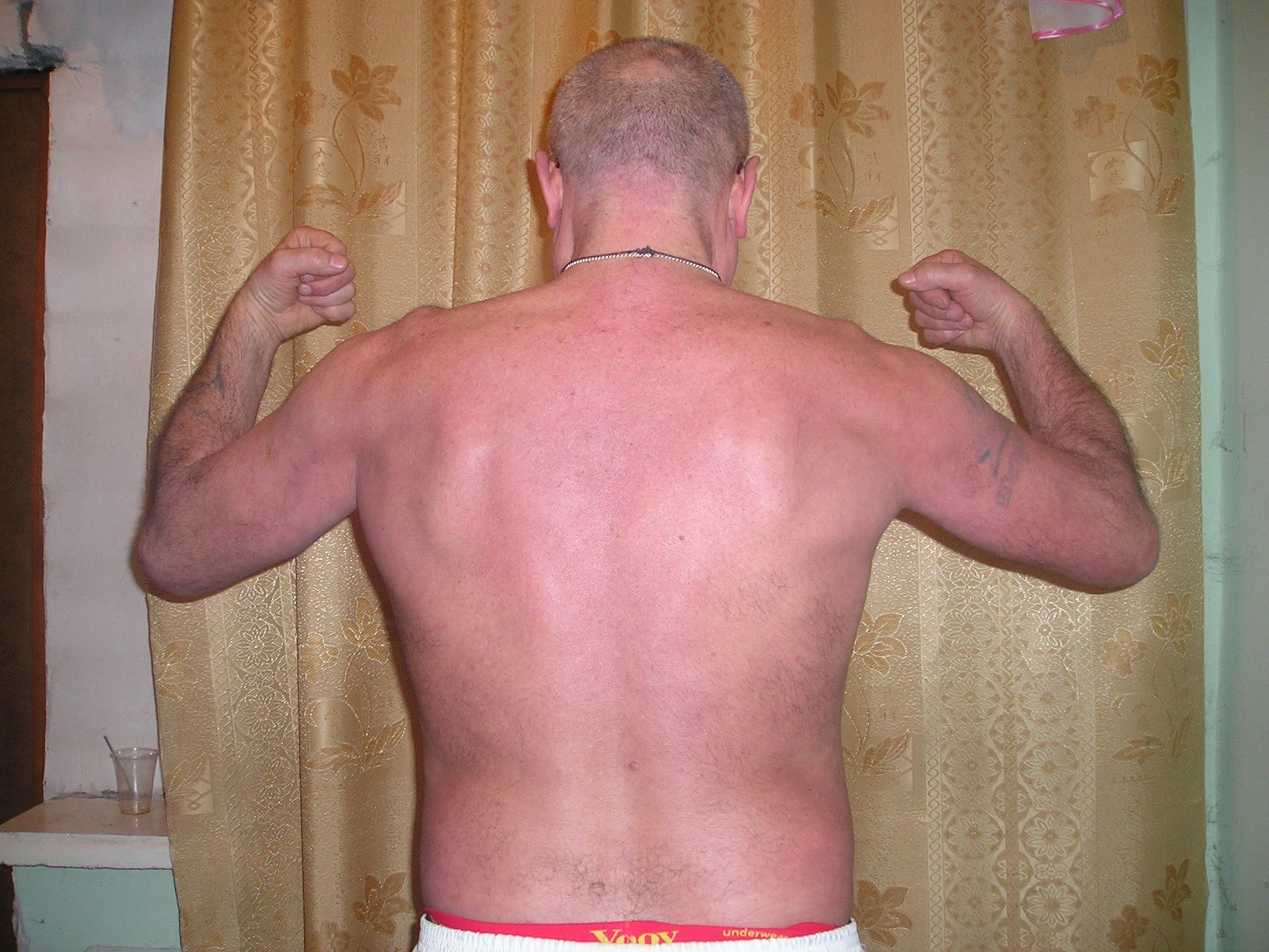 Боль в спине можно победить навсегда! Боль в спине можно победить навсегда!