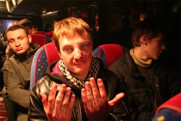 "Битва" под Полтавой: милиция начинает и выигрывает - УП "Битва" под Полтавой: милиция начинает и выигрывает - УП