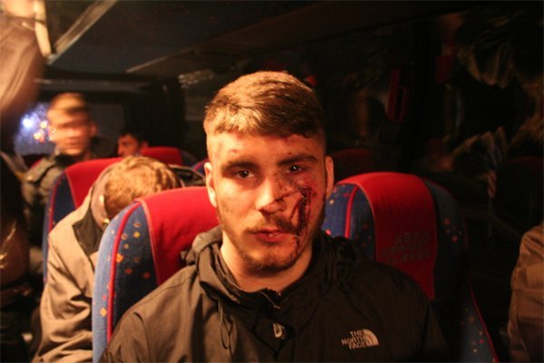 "Битва" под Полтавой: милиция начинает и выигрывает - УП "Битва" под Полтавой: милиция начинает и выигрывает - УП