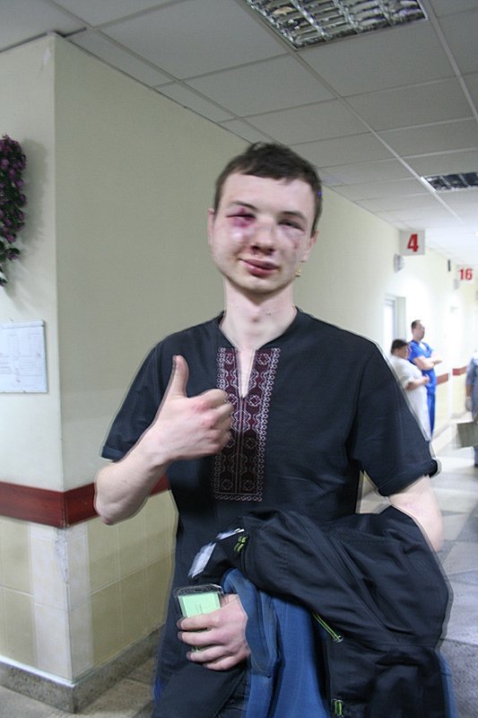 "Битва" под Полтавой: милиция начинает и выигрывает - УП "Битва" под Полтавой: милиция начинает и выигрывает - УП