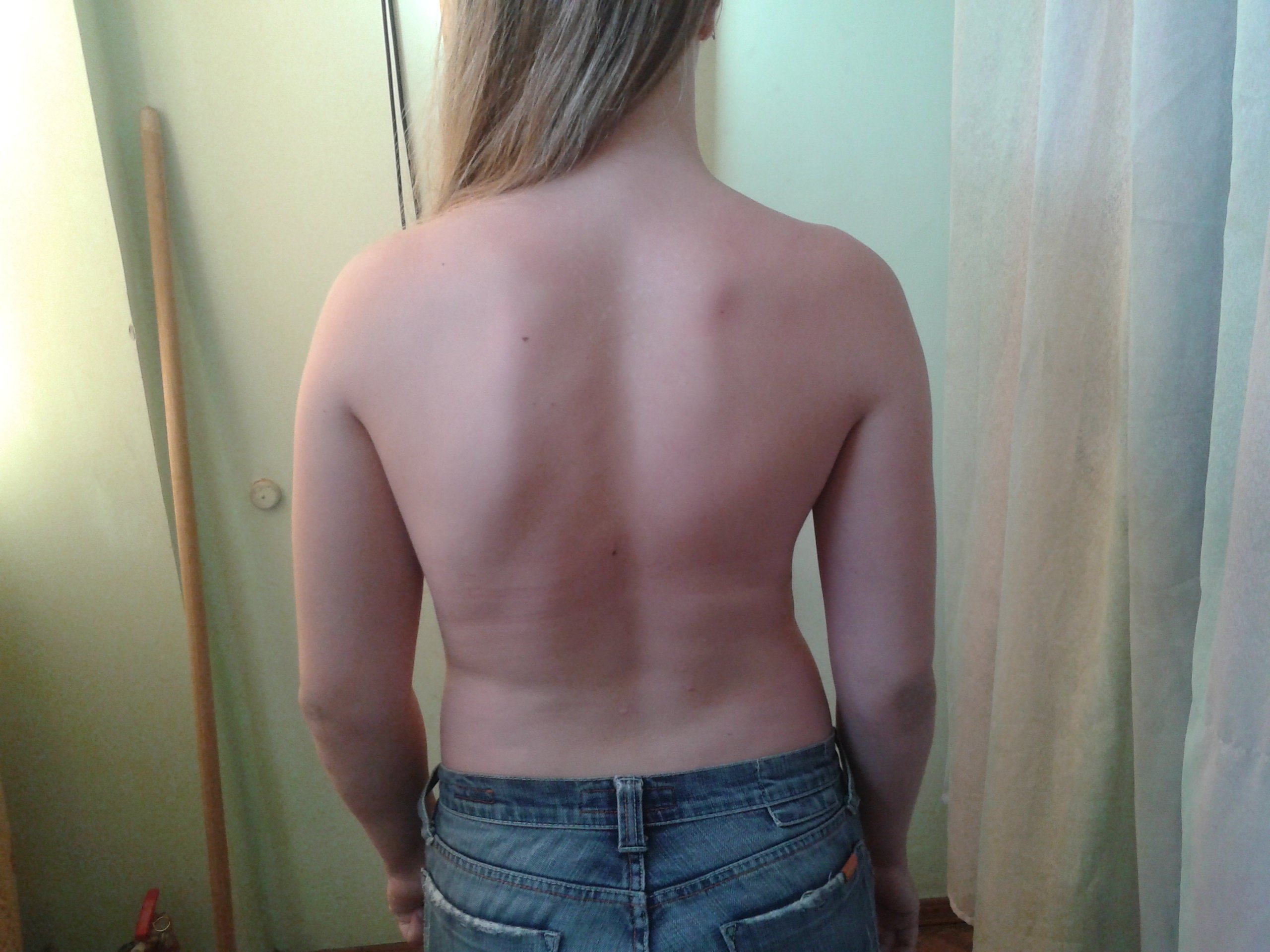 Как навсегда победить боль в спине: 5%-я скидка на профилактор Как навсегда победить боль в спине: 5%-я скидка на профилактор