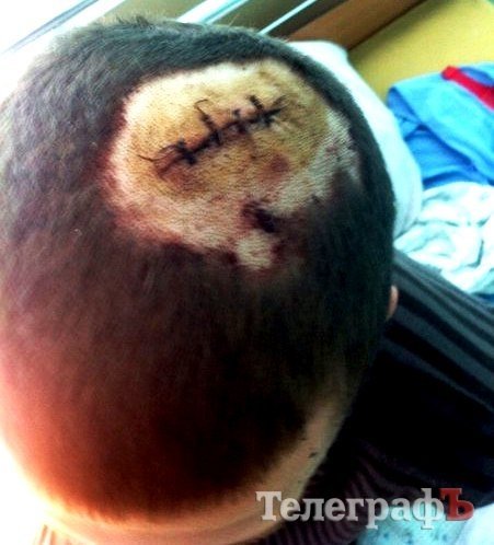 На кременчужанина напали четверо неизвестных с ножом и пистолетом На кременчужанина напали четверо неизвестных с ножом и пистолетом