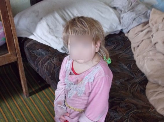 Ужасы на хуторе близ Диканьки: отец с матерью не кормили маленьких детей – истощённые малыши в больнице Ужасы на хуторе близ Диканьки: отец с матерью не кормили маленьких детей – истощённые малыши в больнице