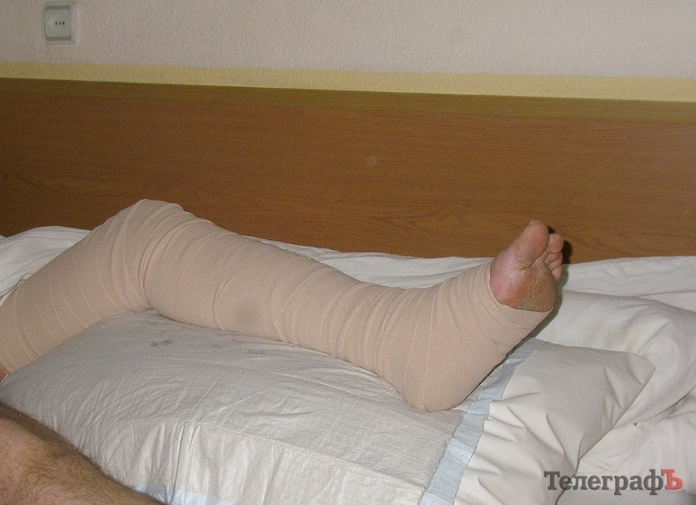 «Дали костыли, билет на вторую полку, и сказали: сам добирайся!» - боец «Дали костыли, билет на вторую полку, и сказали: сам добирайся!» - боец