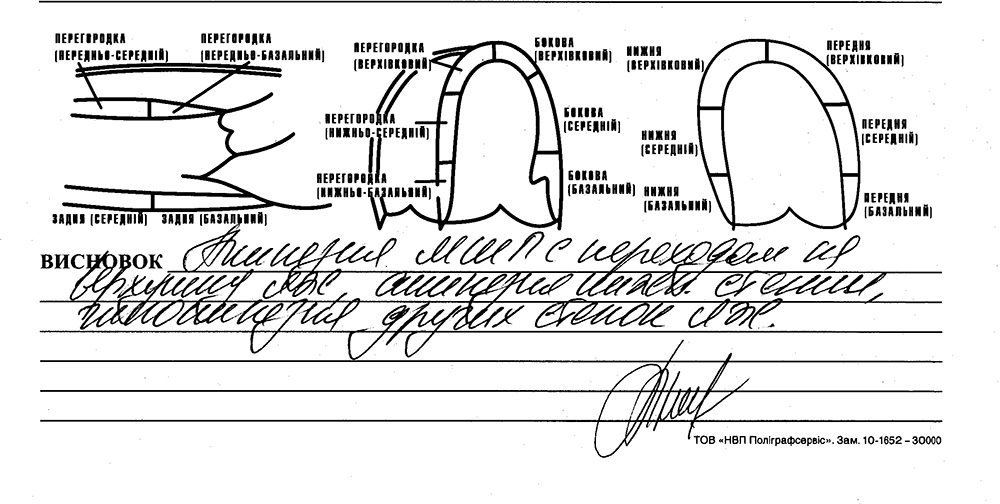Кременчуцький боєць Сергій Іванов потребує коштів на лікування Кременчуцький боєць Сергій Іванов потребує коштів на лікування