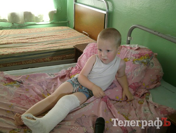 У літній час збільшується травматизм серед дітей У літній час збільшується травматизм серед дітей