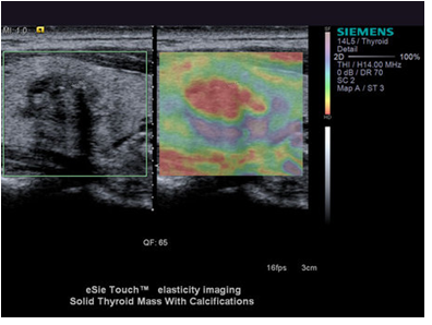 Немецкое качество расширяет диагностические возможности Немецкое качество расширяет диагностические возможности