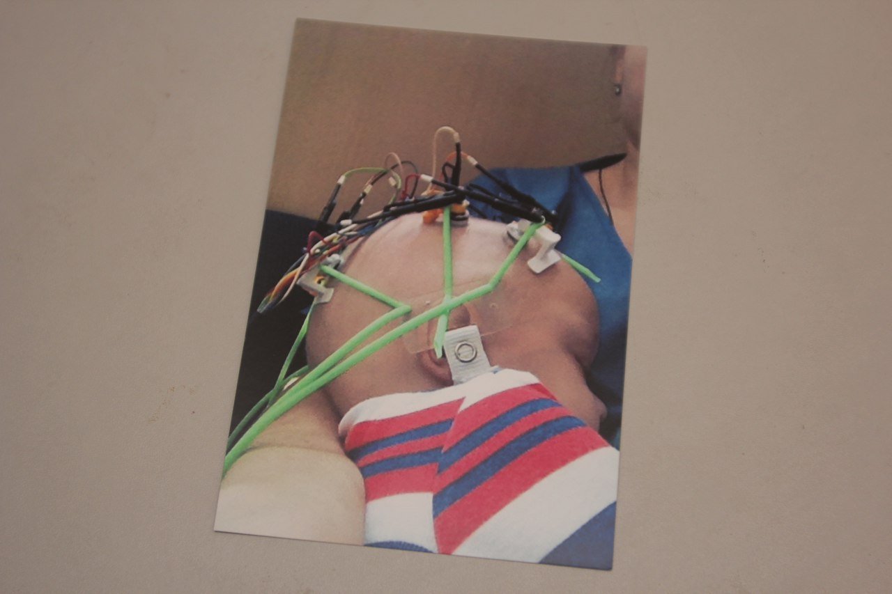 «Ми ледь довезли його до лікарні, Кирило майже не дихав», - бабуся онкохворого кременчужанина «Ми ледь довезли його до лікарні, Кирило майже не дихав», - бабуся онкохворого кременчужанина