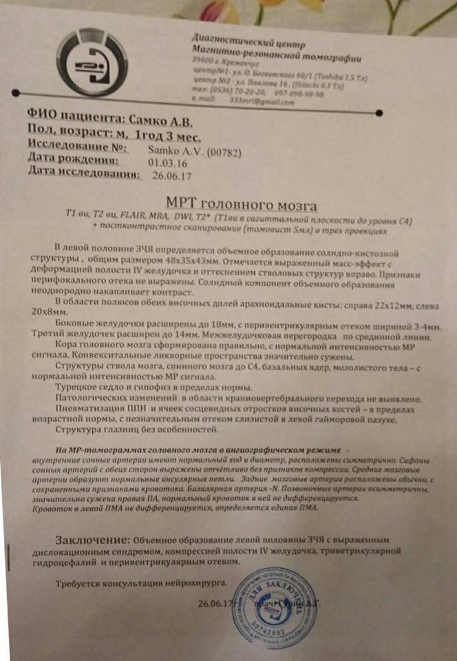 Маленький Артем Самко, у якого виявили пухлину мозку, терміново потребує допомоги Маленький Артем Самко, у якого виявили пухлину мозку, терміново потребує допомоги